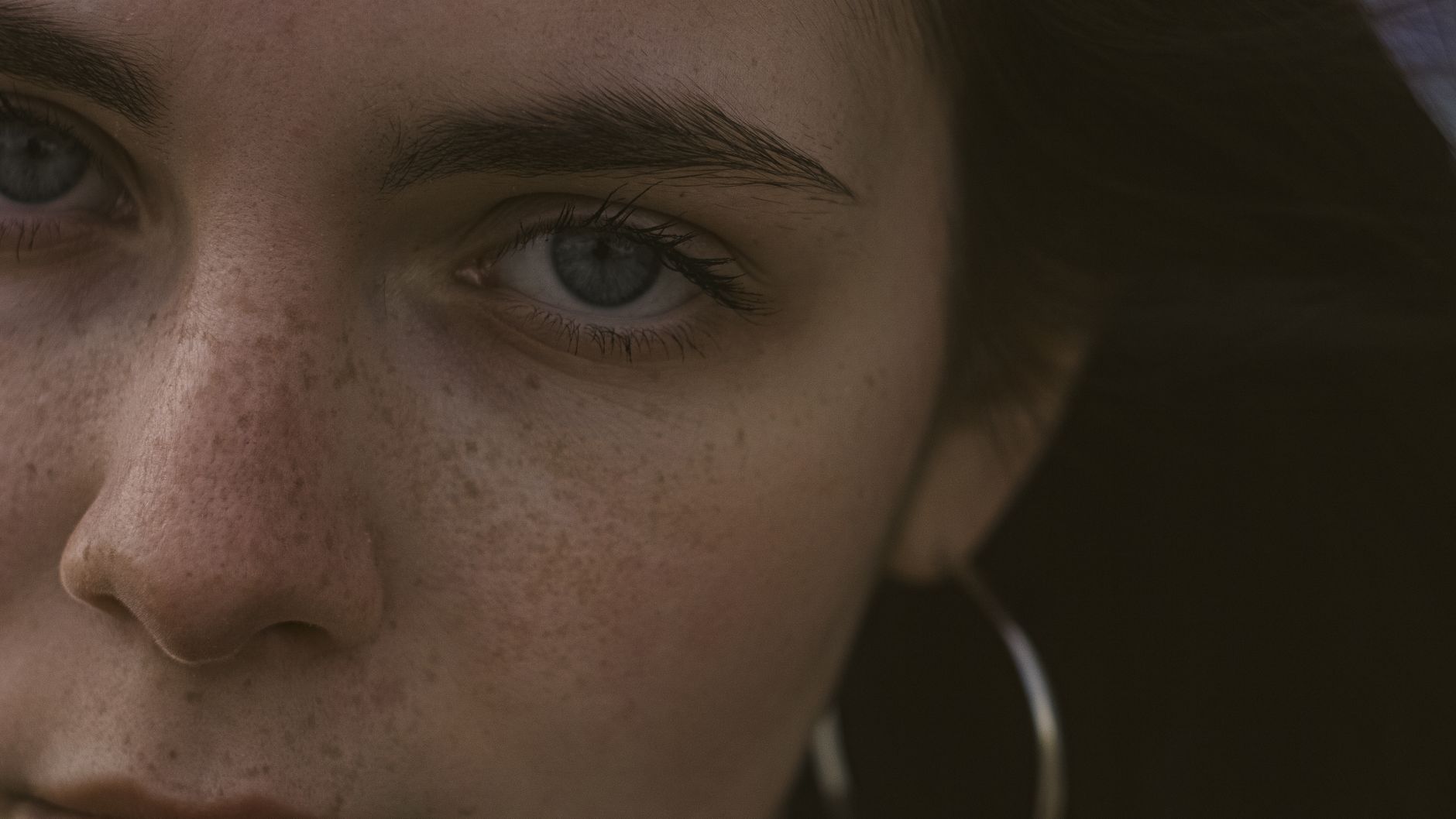Pigmentation & Melasma — Clearbrook Singapore