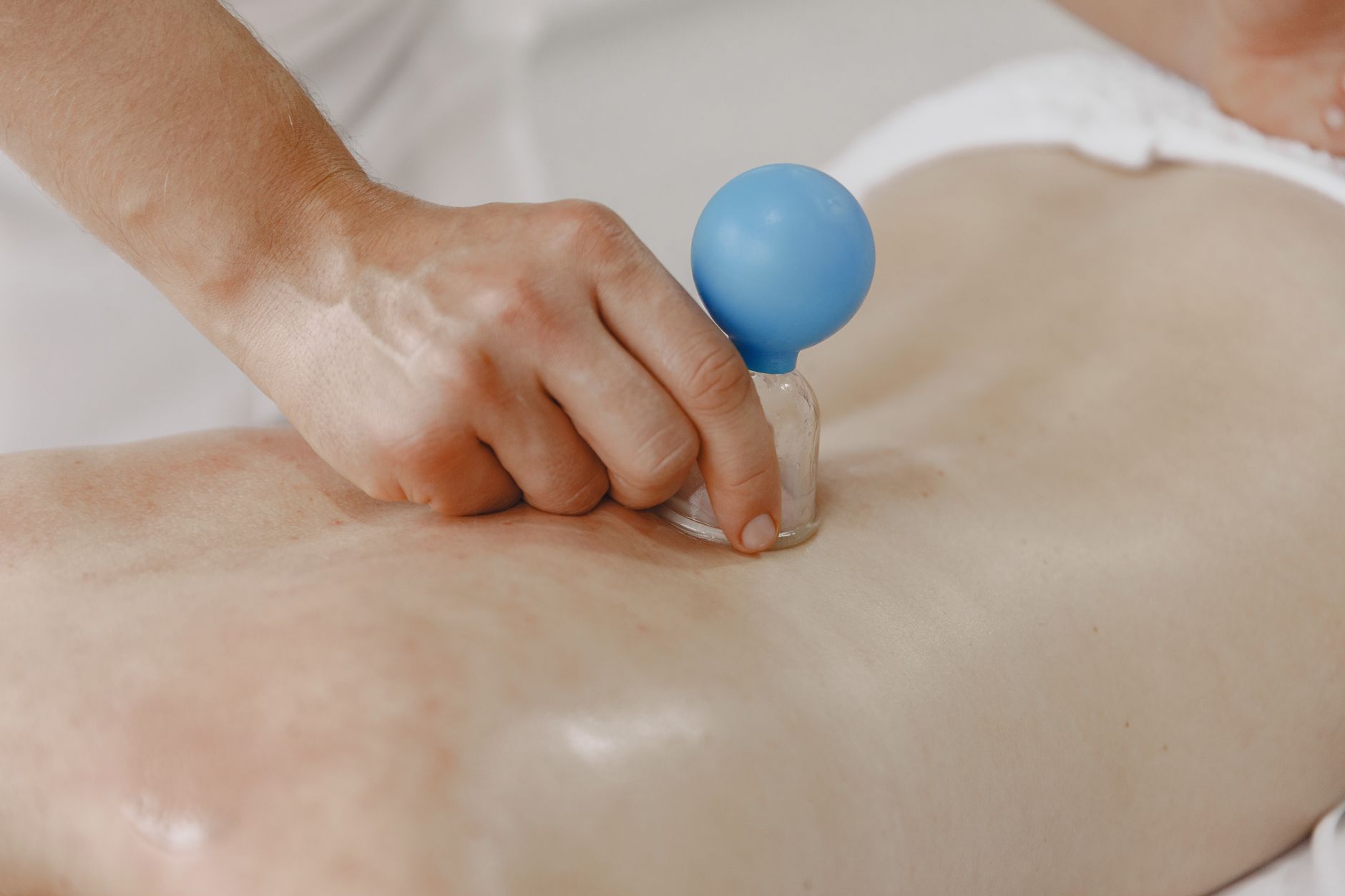 Cupping Therapy (拔罐) at Jadewell TCM, Singapore