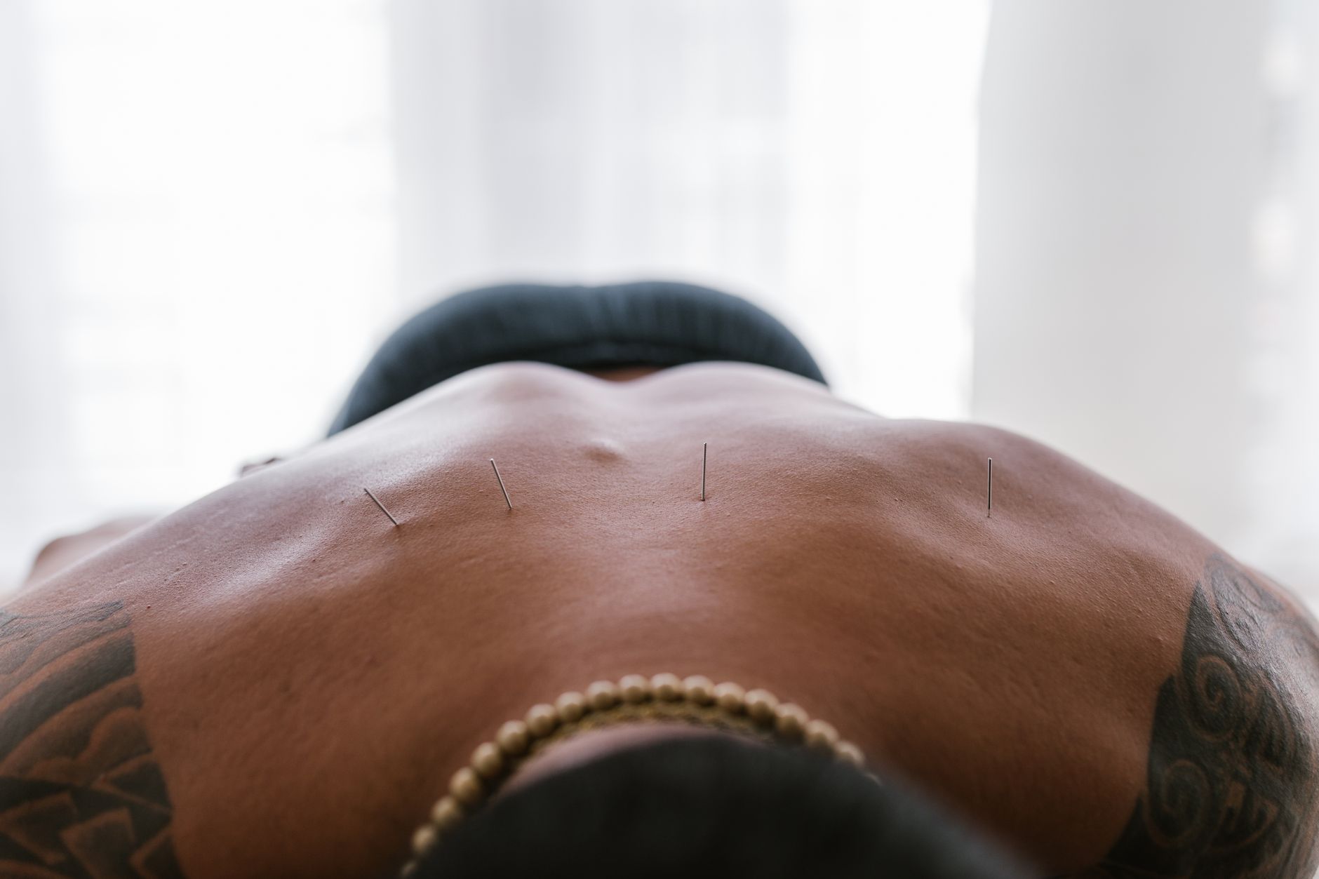 A calm acupuncture treatment at a Singapore TCM clinic
