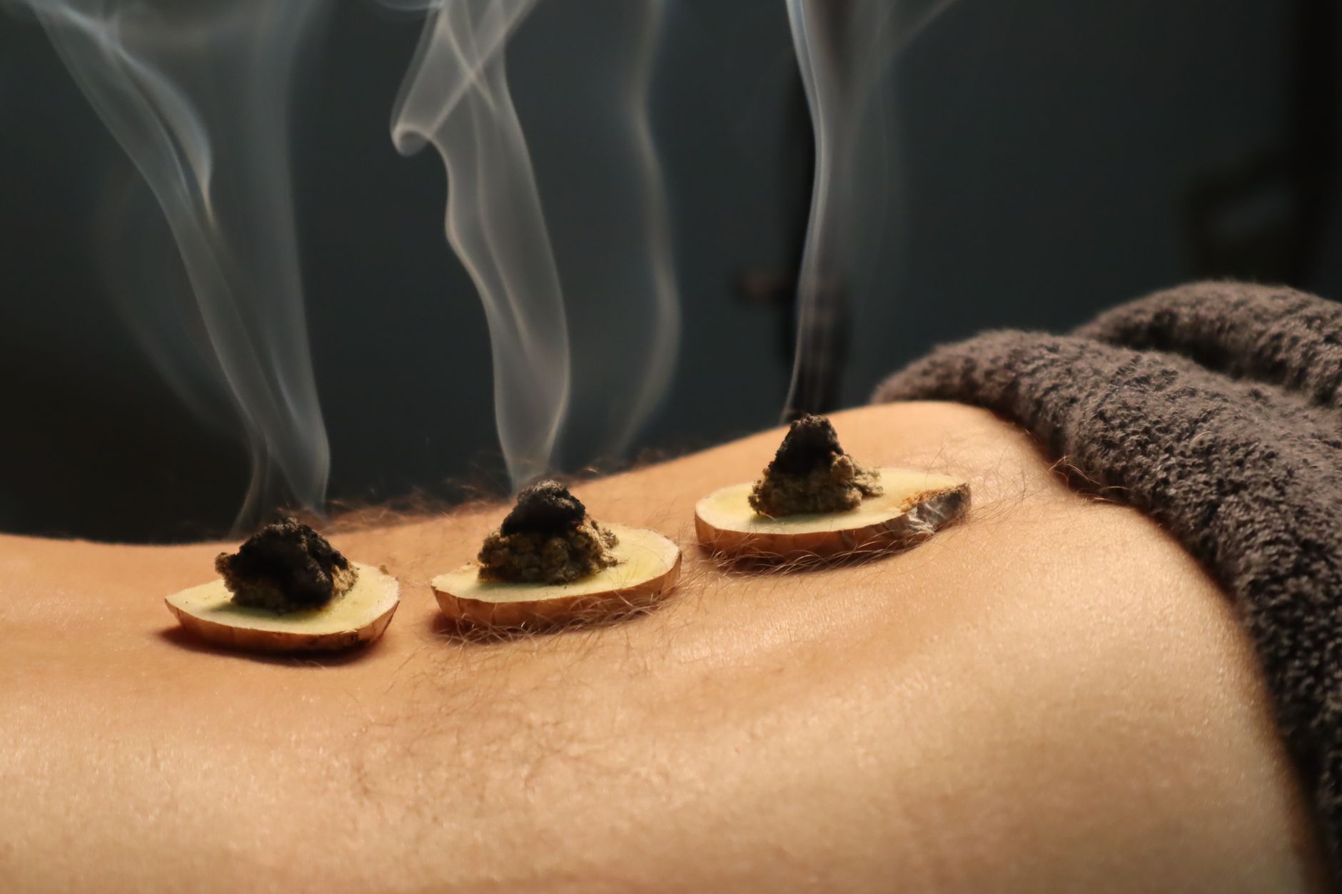 Moxibustion at Jadewell TCM