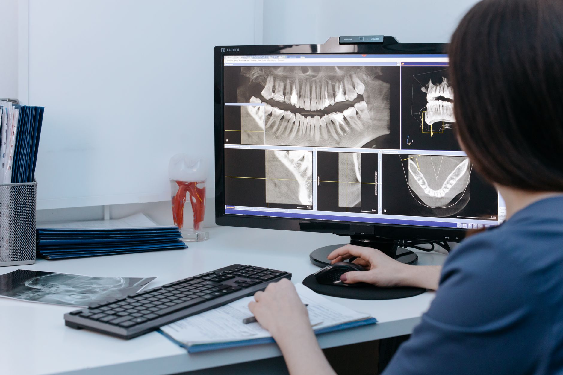 Wisdom Tooth Surgery at Lumio Dental Singapore